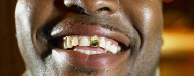 24k-plaque-or-embarque-cz-crystal-star-hiphop-bling-seul-front-dents-grillz.jpg