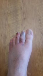 toe.jpg